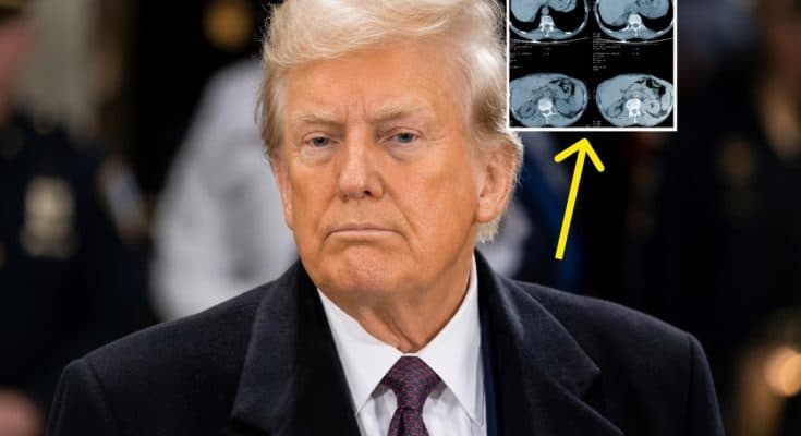 Internet On Edge After Trump Reveals The Results Of His MRI Scan