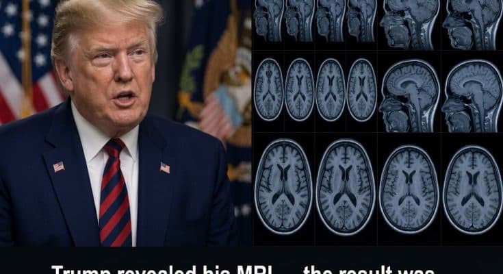 đź§ Internet On Edge After Trump Reveals The Results Of His MRI Scan